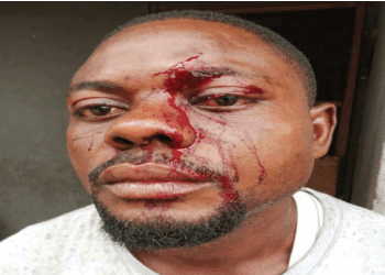 Rivers Landlord Hacks Tenant Over Rent￼