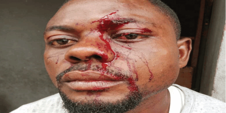 Rivers Landlord Hacks Tenant Over Rent