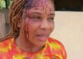 Rivers lady brutalised by man for refusing his relationship request, cries for justice