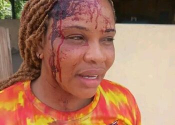 Rivers lady brutalised by man for refusing his relationship request, cries for justice
