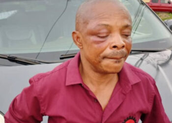 NLC president narrates how he was thoroughly beaten in Imo, says God must have taken extra time to create him