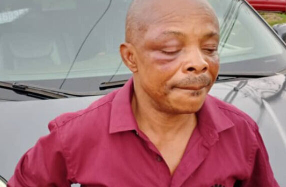 NLC president narrates how he was thoroughly beaten in Imo, says God must have taken extra time to create him