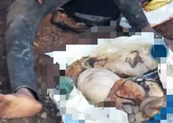 25-year-old man carrying human organs to native doctor for money ritual caught