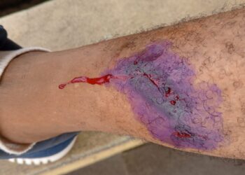 Police shoot Rivers indigenes during protest to assert rights