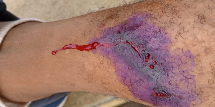 Police shoot Rivers indigenes during protest to assert rights