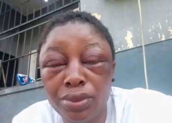 Cross River: Lawmaker suspended indefinitely for beating his wife black and blue