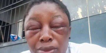 Cross River: Lawmaker suspended indefinitely for beating his wife black and blue