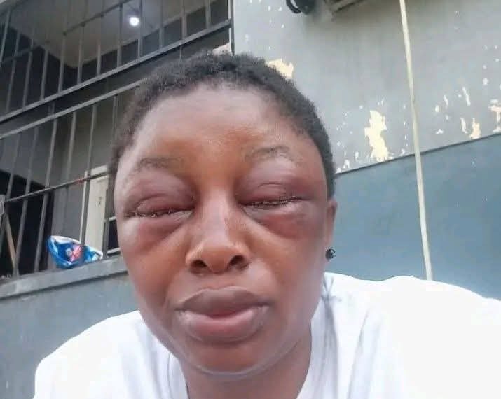 Cross River: Lawmaker suspended indefinitely for beating his wife black and blue